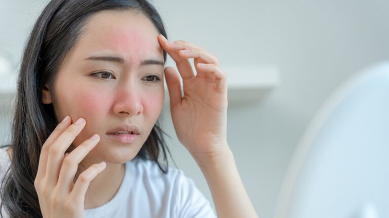 The Hidden Link Between Your Digestion and Your Face